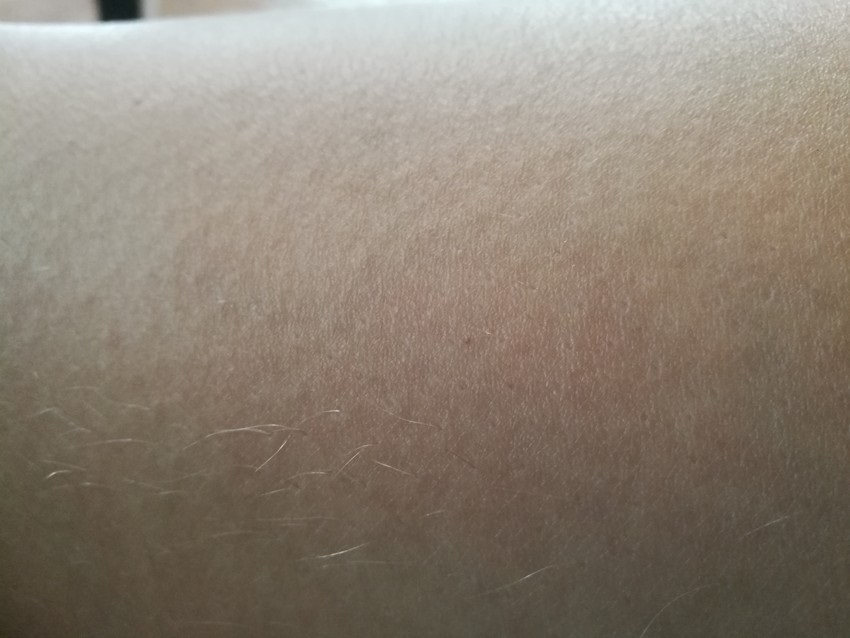 Braun Silk-epil SensoSmart 9-990 – porovnanie epilácie